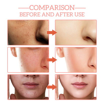 5 In 1 Face Anti Wrinkle Aging Serum